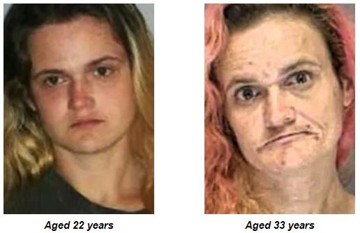 Photo of a woman in which she appears before and after start consuming heroin
