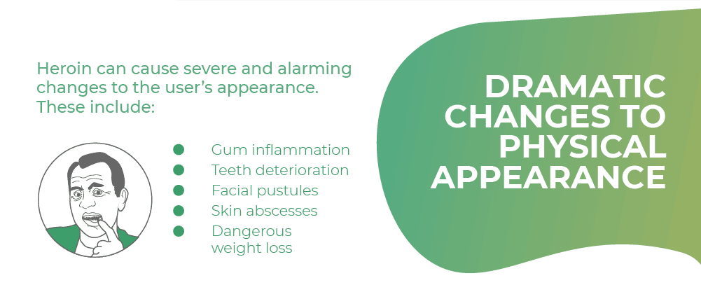 Infographic about dramatic changes to physical appearance